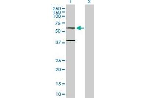 Western Blot analysis of AHCYL1 expression in transfected 293T cell line by AHCYL1 MaxPab polyclonal antibody. (AHCYL1 Antikörper  (AA 1-530))