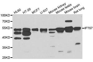 Western blot analysis of extracts of various cell lines, using IFT57 antibody. (IFT57 Antikörper  (AA 170-429))