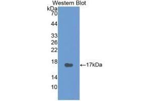 Detection of Recombinant CT, Human using Monoclonal Antibody to Calcitonin (CT) (Calcitonin Antikörper  (AA 85-116))