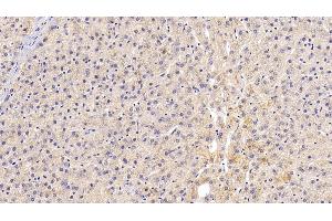 Immunohistochemistry (IHC) image for anti-Galactosidase, beta 1 (GLB1) (AA 68-219) antibody (ABIN7431287)