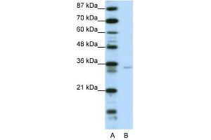Western Blot showing ZNF177 antibody used at a concentration of 1-2 ug/ml to detect its target protein. (ZNF177 Antikörper  (N-Term))