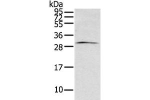Gel: 12 % SDS-PAGE, Lysate: 40 μg, Lane: Mouse brain tissue, Primary antibody: ABIN7193096(ZFAND2B Antibody) at dilution 1/200 dilution, Secondary antibody: Goat anti rabbit IgG at 1/8000 dilution, Exposure time: 1 minute (ZFAND2B Antikörper)