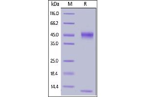 FCGRT & B2M (AA 22-297) protein (His tag)