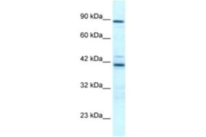 Western Blotting (WB) image for anti-T-Box 5 (TBX5) antibody (ABIN2460713) (T-Box 5 Antikörper)