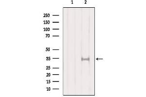 Western blot analysis of extracts from HepG2, using SULT1A1  Antibody. (SULT1A1 Antikörper  (Internal Region))
