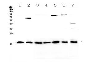 Western blot analysis of IL23 using anti-IL23 antibody . (IL23A Antikörper  (AA 20-178))