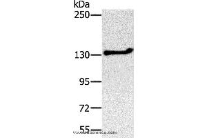 Western blot analysis of Jurkat cell, using NEMF Polyclonal Antibody at dilution of 1:200 (NEMF Antikörper)