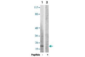 Western blot analysis of extracts from HepG2 cells, using SDC4 polyclonal antibody . (SDC4 Antikörper  (Ser179))