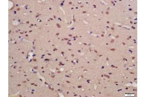 Formalin-fixed and paraffin embedded rat brain labeled with Rabbit Anti-TNIK (Ser769) Polyclonal Antibody, Unconjugated (ABIN711956) at 1:200 followed by conjugation to the secondary antibody and DAB staining