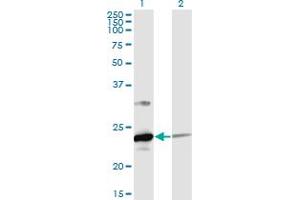 Western Blot analysis of UBE2T expression in transfected 293T cell line by UBE2T monoclonal antibody (M02), clone 4G1-4C2.