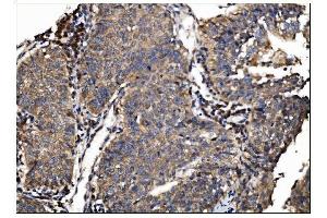 IHC analysis of AS160/TBC1D4 using anti-AS160/TBC1D4 antibody (ABIN7599745). (TBC1D4 Antikörper  (AA 1118-1298))