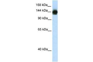 WB Suggested Anti-TIMELESS Antibody Titration:  2. (TIMELESS Antikörper  (N-Term))