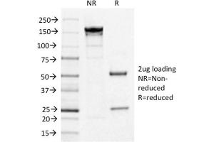 SDS-PAGE Analysis Purified IL3RA/CD123 Mouse Monoclonal Antibody (IL3RA/1531). (IL3RA Antikörper  (AA 26-171))