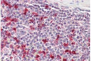 Anti-PTMA antibody IHC staining of human spleen. (PTMA Antikörper  (AA 89-101))
