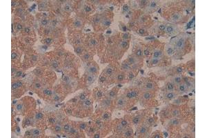DAB staining on IHC-P; Samples: Human Liver Tissue (TOLLIP Antikörper  (AA 28-261))