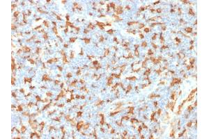 Immunohistochemistry (IHC) image for anti-Ionized Calcium-binding Adapter Molecule 1 (IBA1) (AA 1-146) antibody (ABIN6939298)