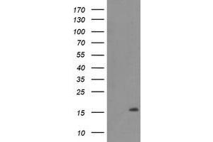 Western Blotting (WB) image for anti-Chromosome 20 Open Reading Frame 30 (C20orf30) antibody (ABIN1498766) (C20orf30 Antikörper)