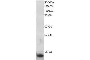Image no. 1 for anti-Suppressor of Cytokine Signaling 3 (SOCS3) (C-Term) antibody (ABIN374066) (SOCS3 Antikörper  (C-Term))