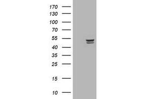 Image no. 3 for anti-Thymidine Phosphorylase (TYMP) (AA 311-482) antibody (ABIN1491394)