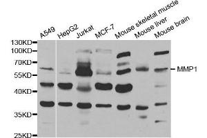 Western blot analysis of extracts of various cell lines, using MMP1 antibody. (MMP1 Antikörper  (AA 20-280))