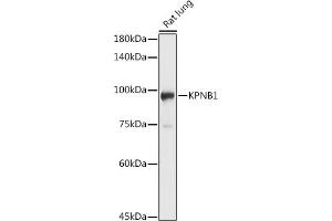 Western blot analysis of extracts of Rat lung, using KPNB1 antibody (ABIN6134722, ABIN6142997, ABIN6142998 and ABIN6224723) at 1:1000 dilution. (KPNB1 Antikörper  (AA 250-350))
