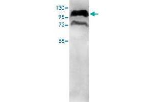 Western blot analysis of HepG2 cell lysate with PPP1R10 polyclonal antibody  at 1 : 500 dilution. (PPP1R10 Antikörper  (AA 661-929))