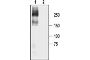 Western blot analysis of NaV1.