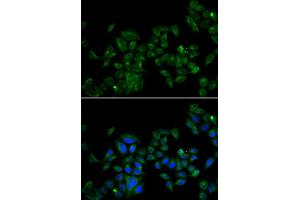 Immunofluorescence analysis of U2OS cell using MAGED1 antibody.