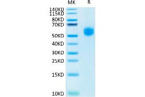 SDS-PAGE (SDS) image for SIRP AlphaV2 protein (His tag) (ABIN7275653)