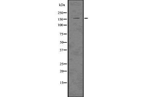Western Blotting (WB) image for anti-LATS, Large Tumor Suppressor, Homolog 1 (Drosophila) (LATS1) (Internal Region) antibody (ABIN6262920)