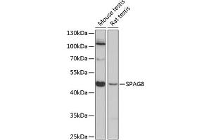 Western blot analysis of extracts of various cell lines, using SP antibody (ABIN6129712, ABIN6148323, ABIN6148324 and ABIN6224831) at 1:3000 dilution.