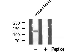 Western blot analysis of PKCB1 expression in Mouse brain lysate (ZMYND8 Antikörper  (Internal Region))