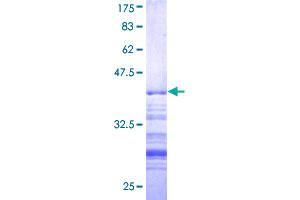 Image no. 1 for Thyroid Hormone Receptor Interactor 12 (TRIP12) (AA 1-110) protein (GST tag) (ABIN1323776)