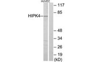 Western Blotting (WB) image for anti-Homeodomain Interacting Protein Kinase 4 (HIPK4) (AA 511-560) antibody (ABIN2889676) (HIPK4 Antikörper  (AA 511-560))