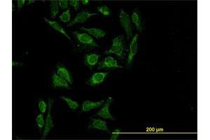 Immunofluorescence of monoclonal antibody to HTRA2 on HeLa cell. (HTRA2 Antikörper  (AA 359-458))