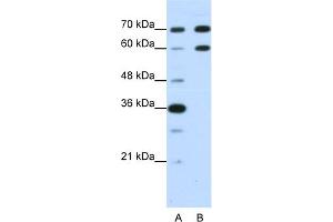 WB Suggested Anti-DMRT2 Antibody Titration:  1. (DMRT2 Antikörper  (N-Term))
