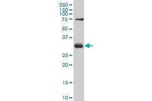 TGIF2 monoclonal antibody (M04), clone 5G6 Western Blot analysis of TGIF2 expression in Hela S3 NE . (TGIF2 Antikörper  (AA 131-236))