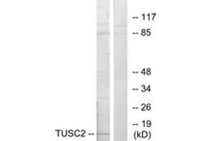 Western blot analysis of extracts from HeLa cells, using TUSC2 Antibody. (TUSC2 Antikörper  (AA 41-90))