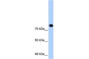 WB Suggested Anti-SMC3 Antibody Titration:  0. (SMC3 Antikörper  (C-Term))