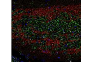 Indirect immunostaining of PFA fixed paraffin-embedded mouse hippocampus section with anti-SV 2C (dilution 1 : 200; red) and rabbit anti-sec 22b (, dilution 1 : 200; green).