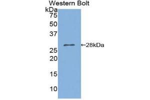 Western blot analysis of the recombinant protein. (PNPLA2 Antikörper  (AA 481-702))