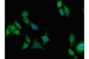 Immunofluorescent analysis of A549 cells using ABIN7159328 at dilution of 1:100 and Alexa Fluor 488-congugated AffiniPure Goat Anti-Rabbit IgG(H+L) (AOC3 Antikörper  (AA 27-259))