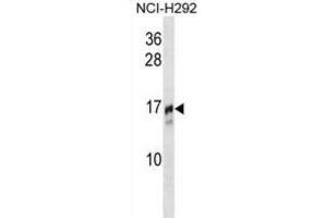 Western Blotting (WB) image for anti-Trafficking Protein Particle Complex 2 (TRAPPC2) antibody (ABIN2995169) (TRAPPC2 Antikörper)