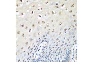 Immunohistochemistry of paraffin-embedded human esophagus using VCP antibody (ABIN6290879) at dilution of 1:200 (40x lens).