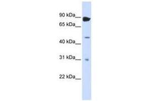 Image no. 1 for anti-Adenosine Deaminase, RNA-Specific, B1 (ADARB1) (N-Term) antibody (ABIN6742969) (RED1 Antikörper  (N-Term))