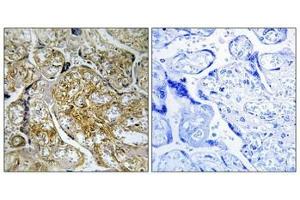 Immunohistochemical analysis of paraffin-embedded human placenta tissue using PAK1/2 (Phospho-Ser199) antibody (left)or the same antibody preincubated with blocking peptide (right). (PAK1 Antikörper  (pSer199))