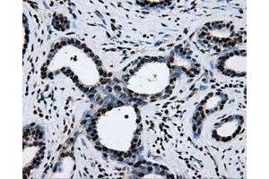 Image no. 13 for anti-Replication Protein A2, 32kDa (RPA2) antibody (ABIN1500733)