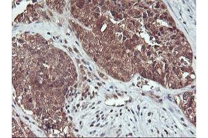 Image no. 4 for anti-Haloacid Dehalogenase-Like Hydrolase Domain Containing 1 (HDHD1) antibody (ABIN1498625) (HDHD1 Antikörper)