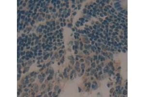IHC-P analysis of Human Tissue, with DAB staining. (CCL21 Antikörper  (AA 24-134))