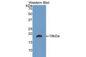 Detection of Recombinant LAMa1, Human using Polyclonal Antibody to Laminin Alpha 1 (LAMA1) (Laminin alpha 1 Antikörper  (AA 886-1039))